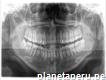 Rx Panorámica Y Tomografía Dental Raydentx
